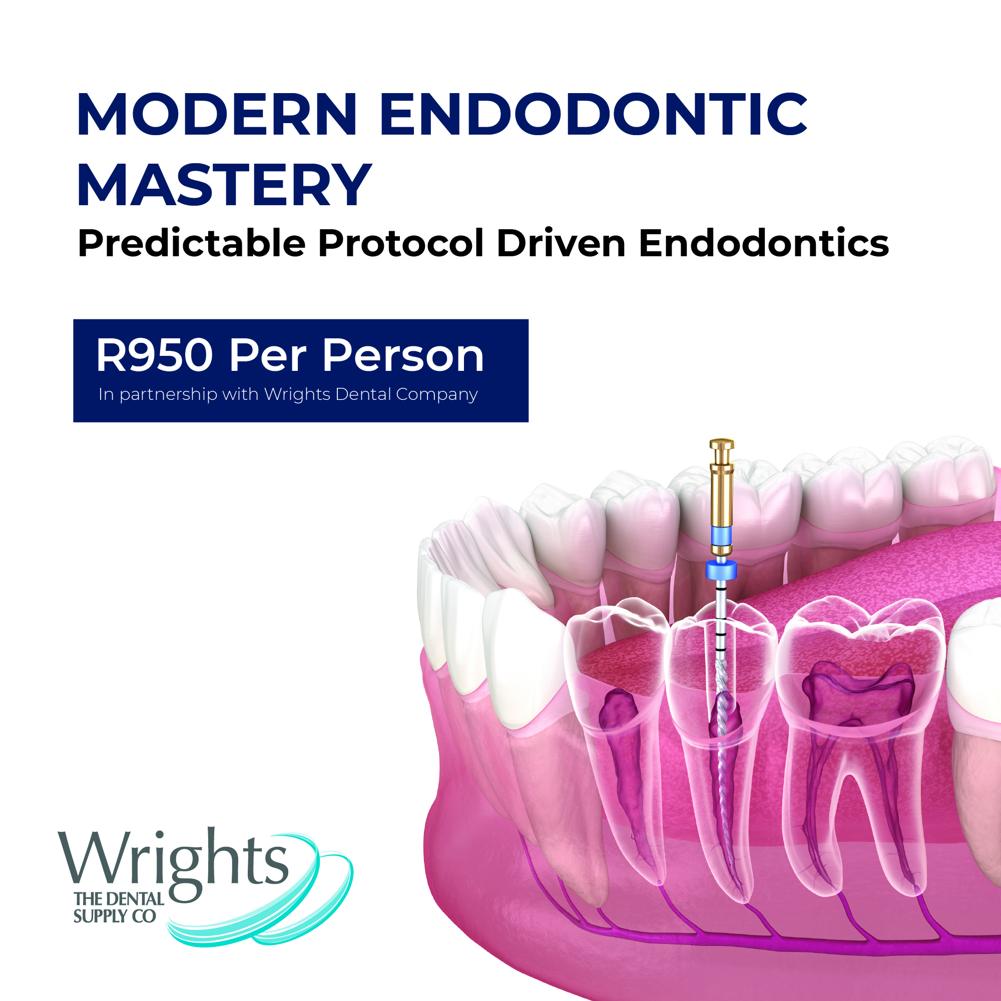 JHB - Modern Endodontic Mastery With Dr E Patel